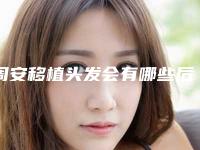 周安移植头发会有哪些后遗症